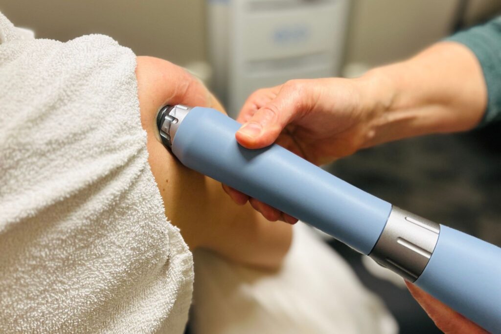 Physiotherapy patient receiving extracorporeal shockwave therapy at Moveo Physio in Orleans, Ottawa, Ontario